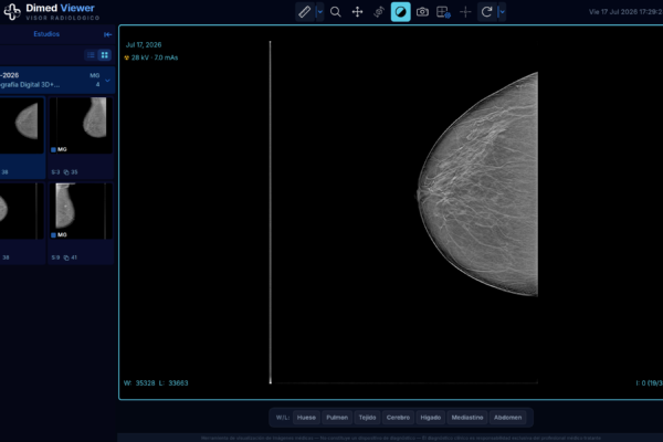 Visor web del PACS mostrando tomosíntesis digital de mama con cortes 3D